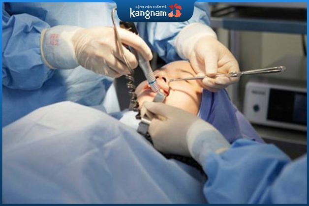 Thực hiện gây tê