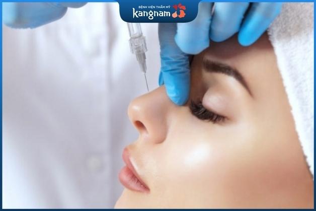 Tiêm filler mũi có cả ưu và nhược điểm