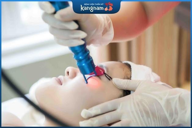 Trị sẹo bằng laser tồn tại một số mặt hạn chế