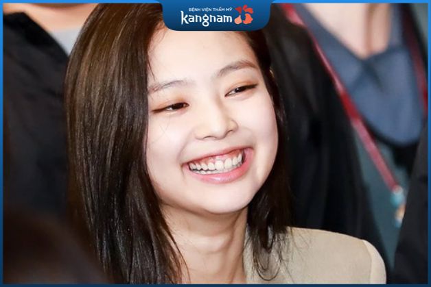 Tướng số nữ giới cười hở lợi