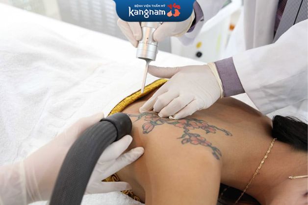 Xem xét bệnh sử của bạn trước khi xóa xăm