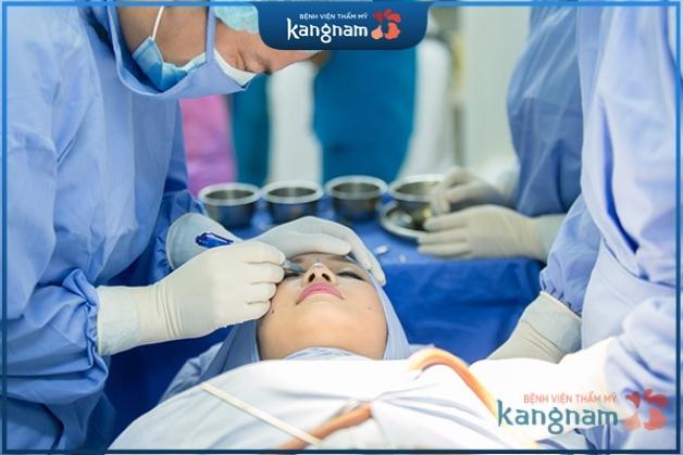 Tìm hiểu cách sửa mũi S-Line đẹp tự nhiên sau 7 ngày