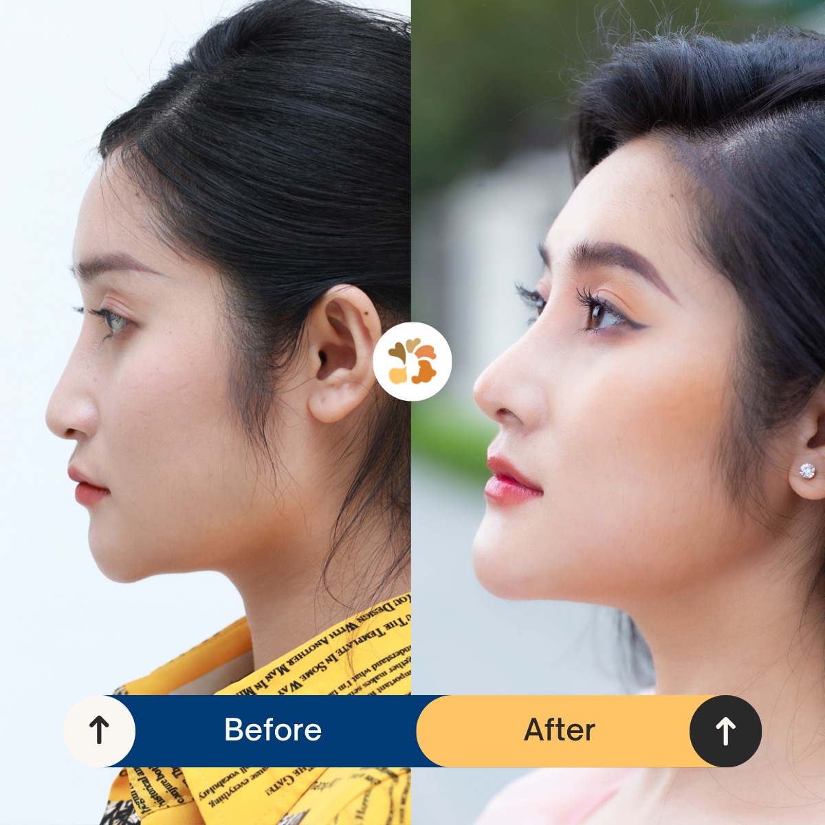 Khách hàng Tú Linh review về dịch vụ gọt hàm tại Kangnam Thanh Hóa