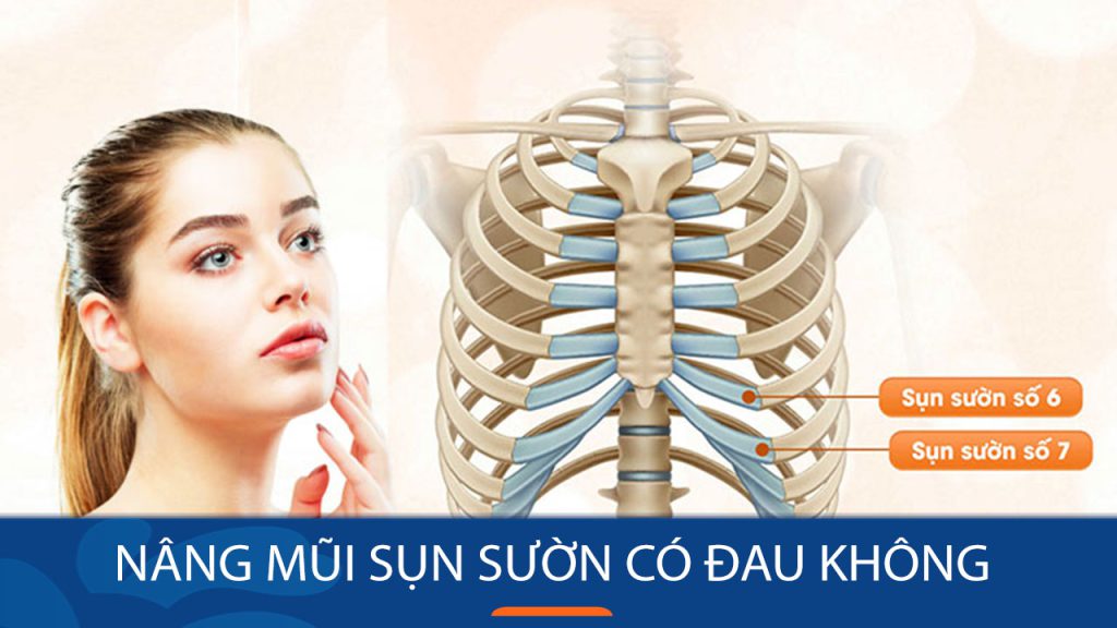 Nâng mũi sụn sườn có đau không? Mức độ đau, thời gian đau & cách giảm đau