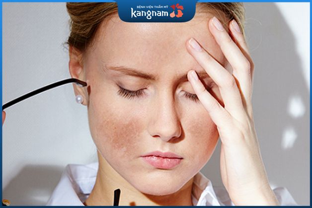 Ánh nắng mặt trời