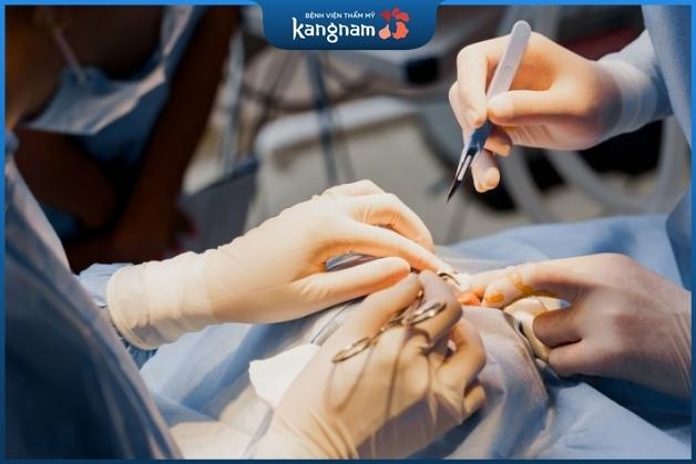 Bác sĩ phẫu thuật có tay nghề giỏi, tỷ lệ thành công cao