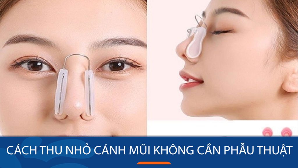 Cách thu nhỏ cánh mũi không cần phẫu thuật: Bác sĩ chia sẻ