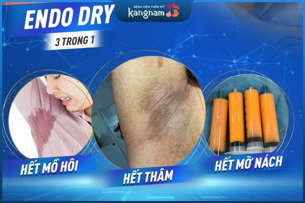 Chữa trị hôi nách hiệu quả với công nghệ Endo Dry