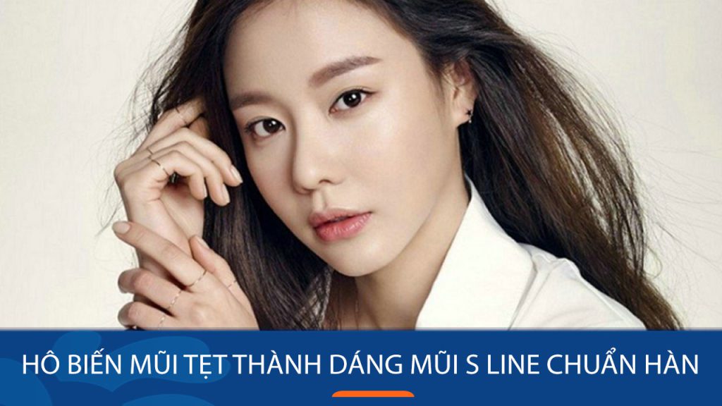 Hô biến mũi tẹt thành dáng mũi s line chuẩn hàn