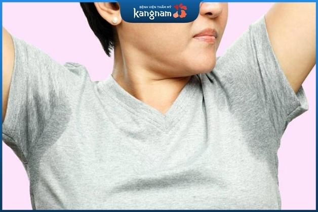 Mồ hôi nách có chữa được không