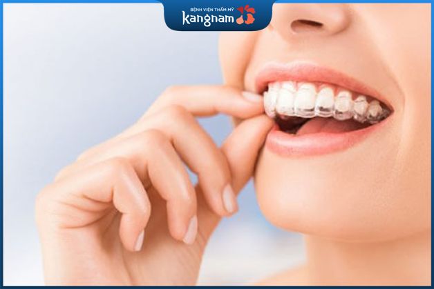 Có tính thẩm mỹ vượt trội