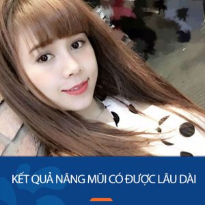 Nâng mũi có được lâu dài không – Bí quyết sở hữu nhan sắc tự nhiên bền lâu