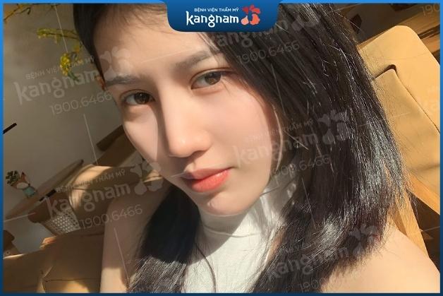 cách sửa mũi s line