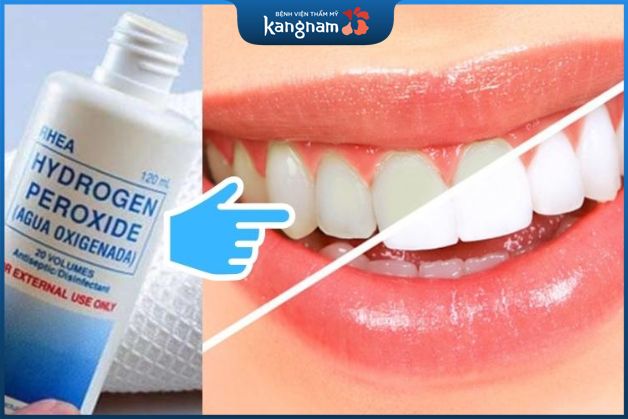 Cách làm trắng răng bằng oxy già