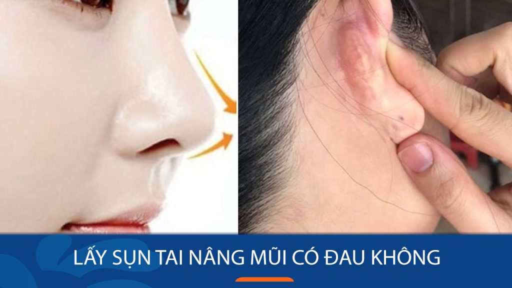 Lấy sụn tai nâng mũi có đau không? Mức độ đau, an toàn & lưu ý