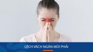 lech-vach-ngan-mui-phai