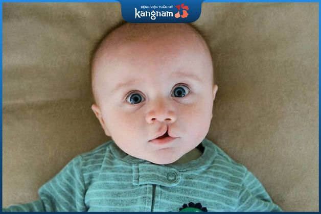 Thời điểm thực hiện phẫu thuật hở hàm ếch còn tòa thuộc vào tình trạng của từng trẻ