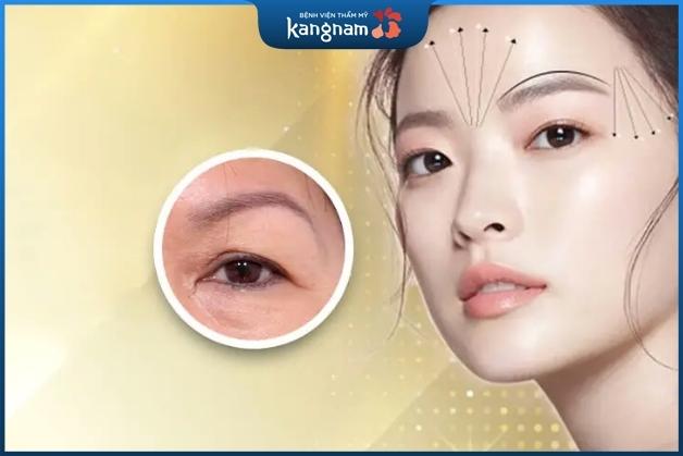 Khách hàng an tâm khi nâng chân mày trẻ hóa nhan sắc tại Kangnam