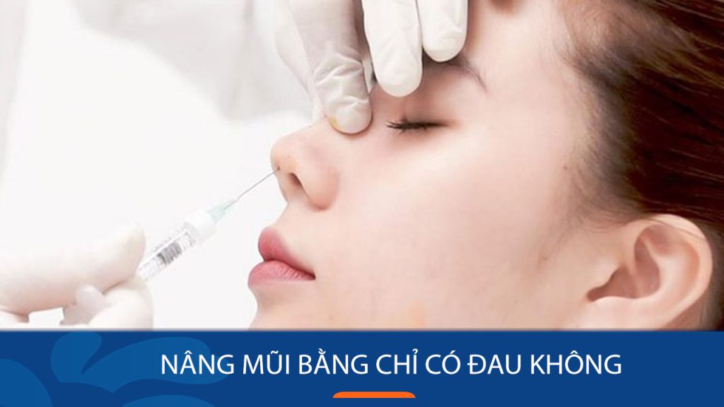 Nâng mũi bằng chỉ có đau không? Bác sĩ giải đáp
