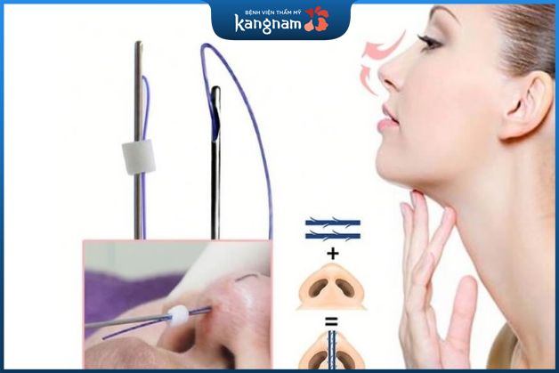 Nâng mũi bằng chỉ có đau không?