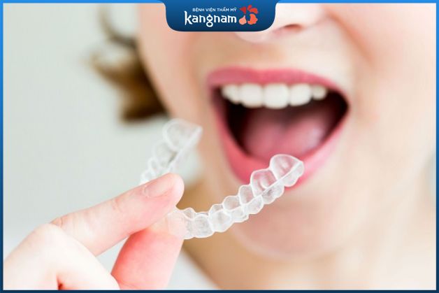 Niềng răng tháo lắp trong suốt