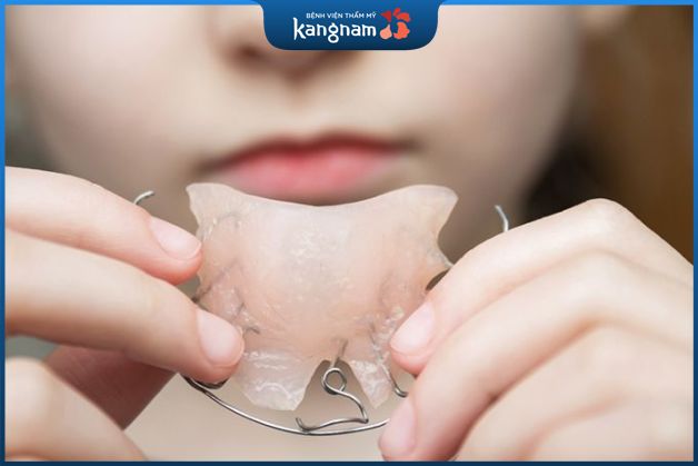 Niềng răng tháo lắp trẻ em bằng tháo lắp kim loại