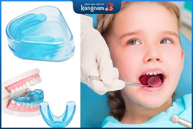 Niềng răng tháo lắp trẻ em bằng khay mọc răng