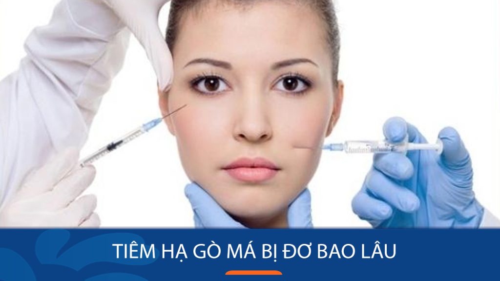 Tiêm hạ gò má bị đơ bao lâu? 7 lưu ý trong cách chăm sóc để có kết quả mềm mại