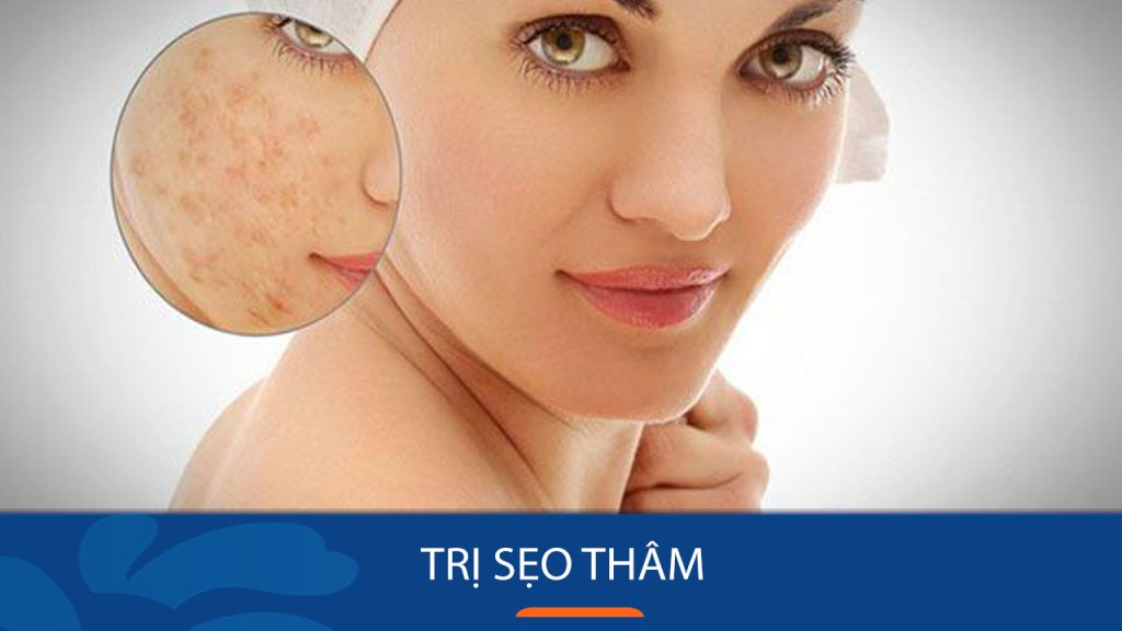 13 Kem Trị Sẹo Thâm Hiệu Quả Nhất 2025