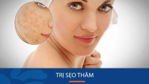 13 Kem Trị Sẹo Thâm Hiệu Quả Nhất 2025