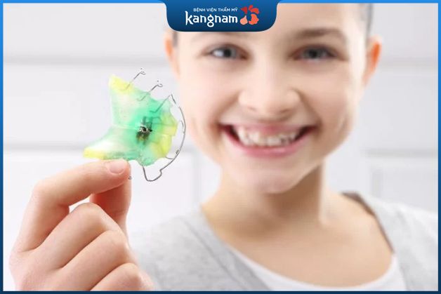 Những ưu điểm của niềng răng tháo lắp trẻ em