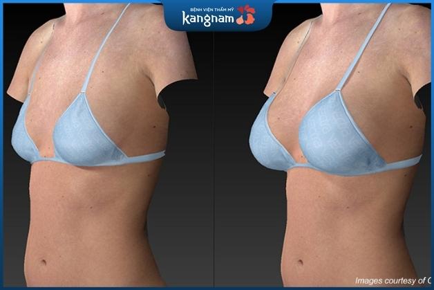 Khách hàng tự tin với vòng 1 căng đầy quyến rũ, hợp với tỷ lệ thân hình