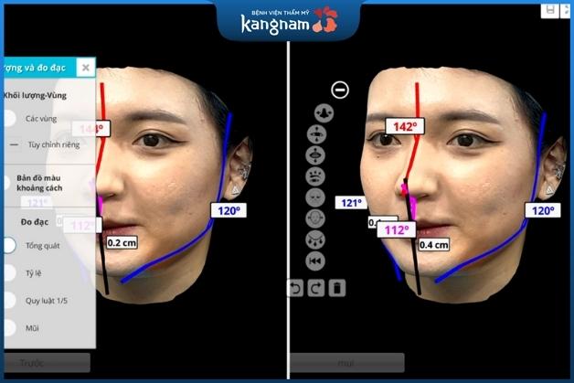 Vectra 3D được ứng dụng trong thẩm mỹ