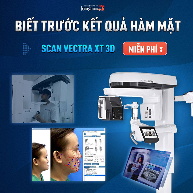 Thiết bị Vectra 3D cho phép xem trước kết quả tại Kangnam.