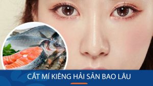 Cắt mí kiêng hải sản bao lâu? Cần lưu ý điều gì sau khi cắt mí