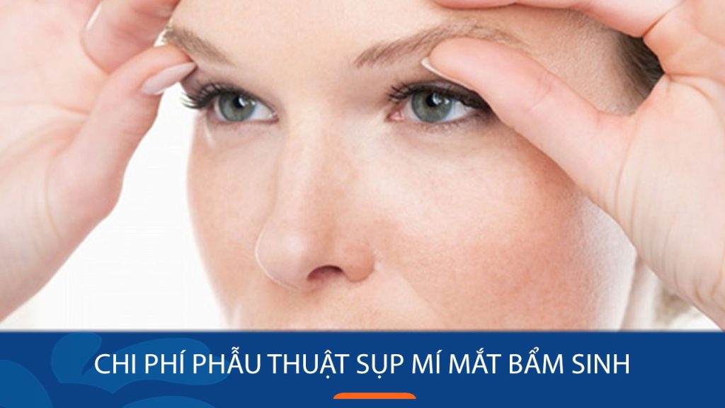 Chi phí phẫu thuật sụp mí mắt bẩm sinh bao nhiêu? Các yếu tố ảnh hưởng
