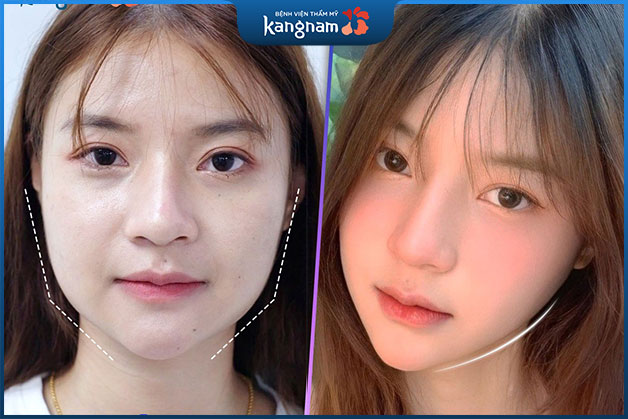 Khách hàng Thùy Tiên