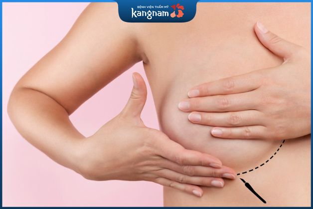 Nâng ngực là tiểu phẫu hay đại phẫu?