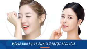 Nâng mũi sụn sườn giữ được bao lâu? Yếu tố quyết định độ bền dáng mũi