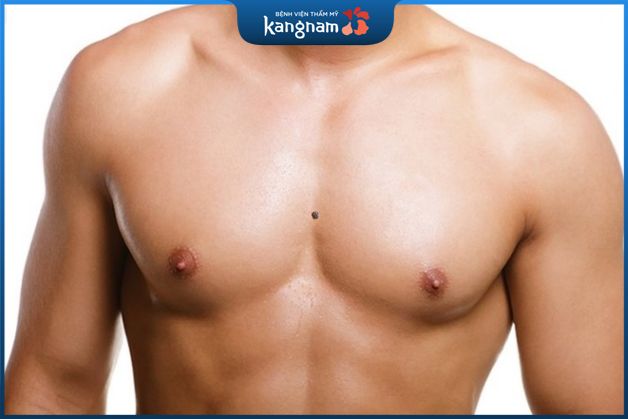 Nốt ruồi mọc giữa ngực