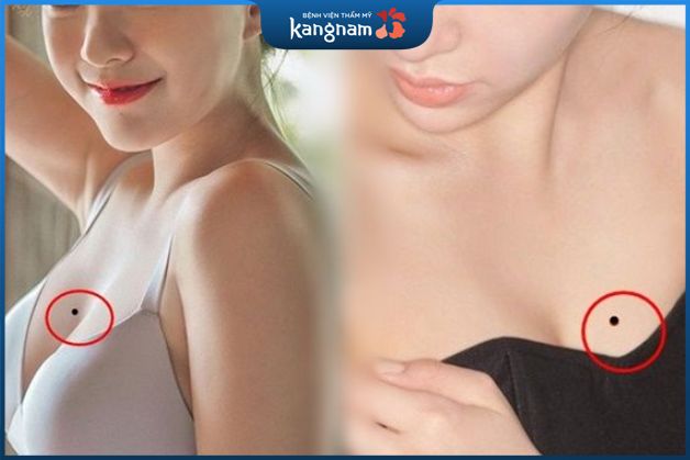 Phụ nữ có nốt ruồi ở ngực hầu hết đều may mắn
