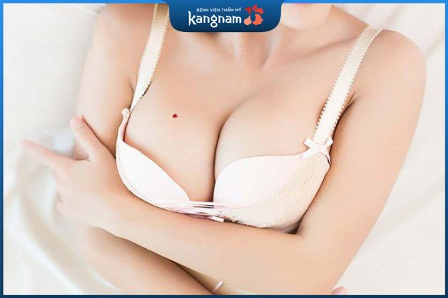 Nốt ruồi son ở ngực phải