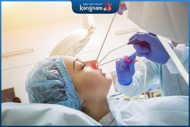 Phẫu thuật chỉnh xương mũi cần được thực hiện đúng quy trình