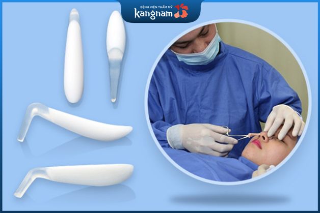 Tháo sụn mũi không đau đớn