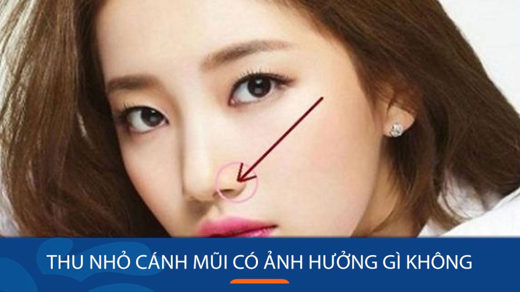 Thu nhỏ cánh mũi có ảnh hưởng gì không? Góc nhìn y khoa & lưu ý an toàn