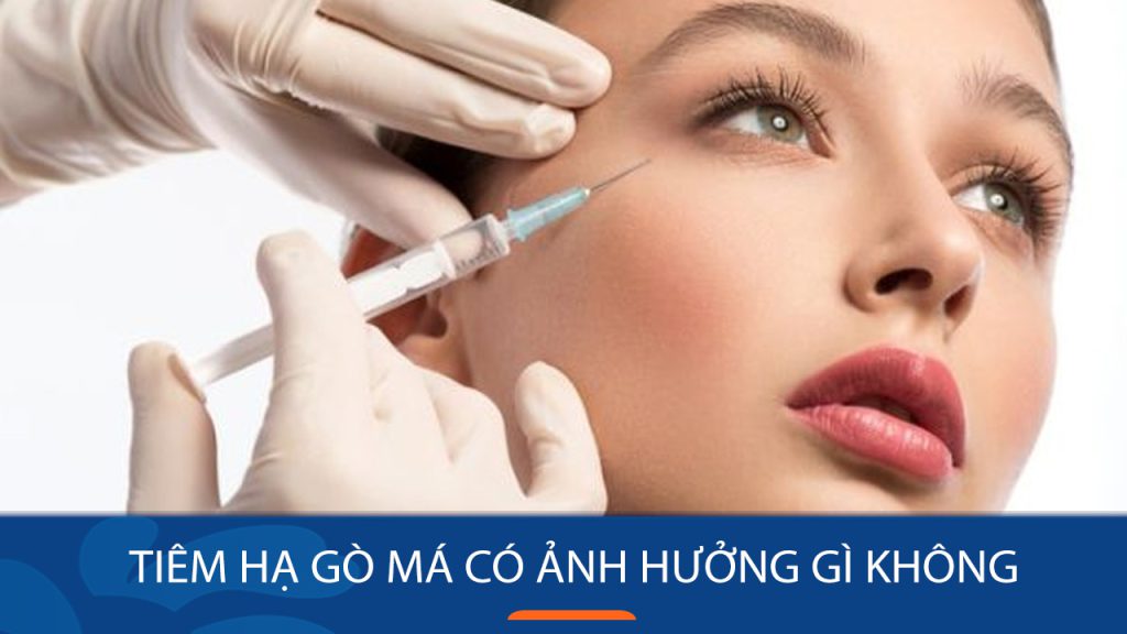 Tiêm hạ gò má có ảnh hưởng gì không? Giải đáp mọi thắc mắc
