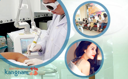 Xóa xăm vùng kín phụ nữ tại BVTM Kangnam xoa xam vung kin phu nu tai kangnam