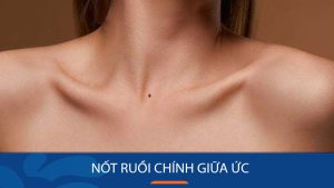 Nốt ruồi son giữa ngực: Tướng giàu sang, phú quý hay đen đủi?