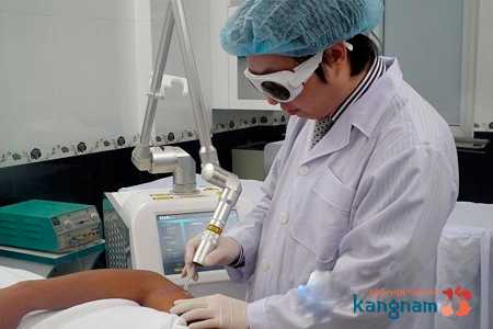 cách xóa hình xăm trên người không đau