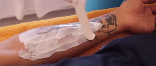 Cách xóa hình xăm trên người bằng laser